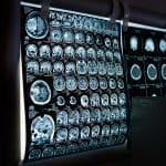 Buyer traffic brain
