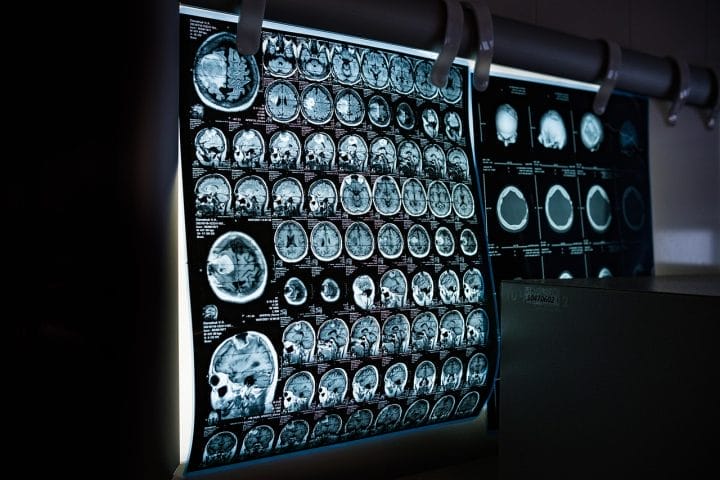 Buyer traffic brain